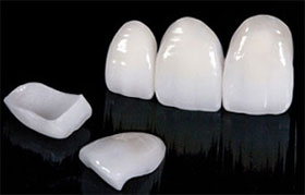 لامینیت دندان